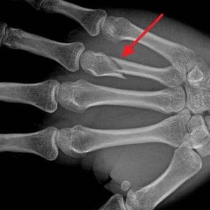 Meet your Posher, Maureen